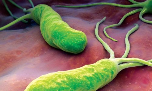 Эрозивный антральный гастрит при панкреатической болезни часто формируется под воздействием бактерии Хеликобактер пилори